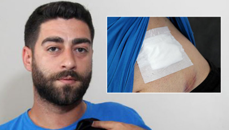 Karnında ağrı hissetti! Baktığında kan gördü! Gerçek röntgende belli oldu!