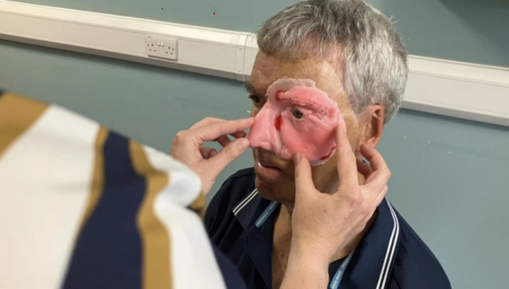 Bisiklet kazasında yüzünde ağır hasar oluşmuştu: 3D merkezde tedavi gördü