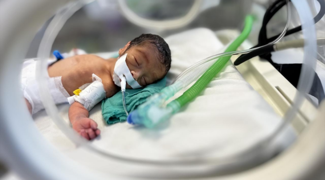 Gazze'de biri bebek 2 çocuk daha açlıktan hayatını kaybetti