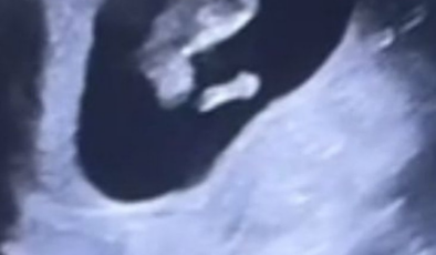 Beste Kökdemir düğün gününde bebek müjdesi verdi