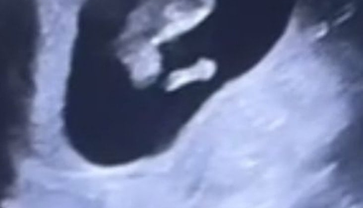 Beste Kökdemir düğün gününde bebek müjdesi verdi
