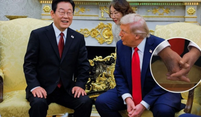 Herkes Trump'ın elindeki morlukları merak etmişti: Beyaz Saray'dan açıklama geldi