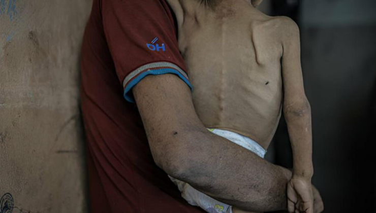 UNRWA Genel Komiseri: Gazzede açlık herkesi yavaş ve sessiz bir ölüme mahkum etti