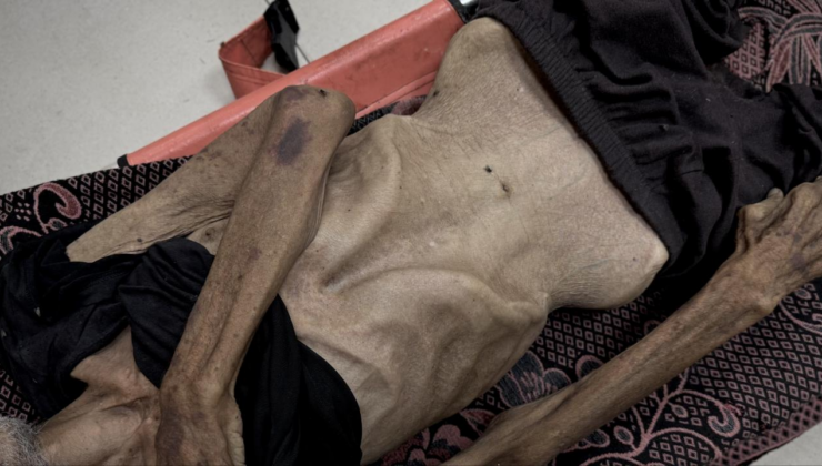 İsrail'in kıtlığı dayattığı Gazze'de son 24 saatte 5 kişi daha açlıktan hayatını kaybetti