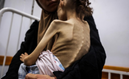 Gazzede 9 yaşındaki Meryem, 25 kilodan 10 kiloya düştü