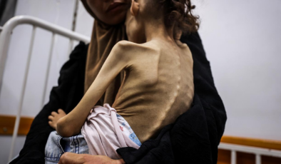 Gazzede 9 yaşındaki Meryem, 25 kilodan 10 kiloya düştü