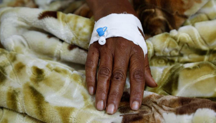 Sudan'da bir haftada 2 bin 345 kolera vakası kaydedildi, 21 kişi öldü