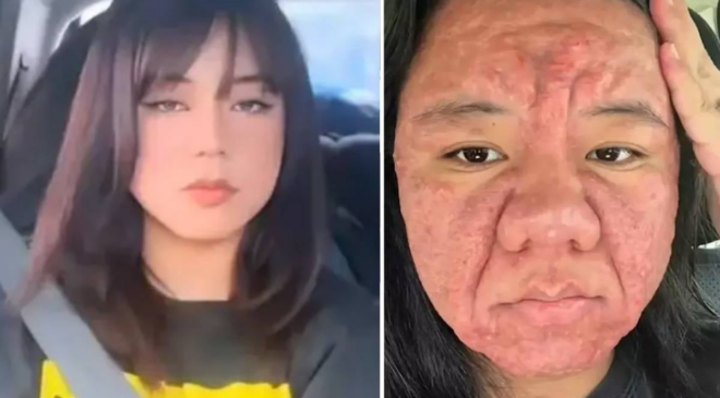 28 yaşındaki kadın bir günde 30 yıl yaşlandı: İşte nedeni