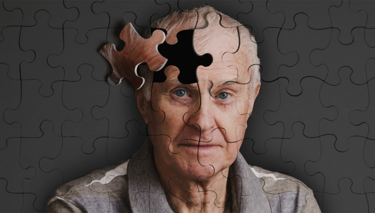 Bilim dünyasından sevindiren keşif: Alzheimer'ın nedeni bulundu
