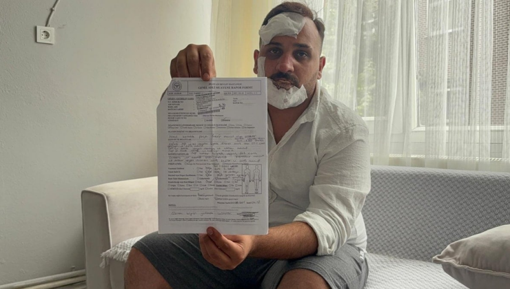 Eski sözlüye, polislerden öldüresiye dayak: 'Sülaleni öldürürüz'