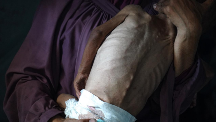 Gazze'de son 24 saatte 5 Filistinli daha açlıktan hayatını kaybetti