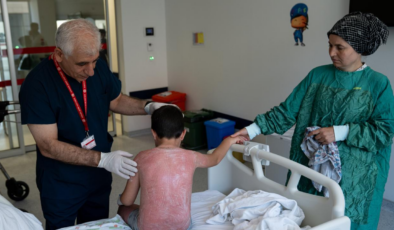 Güneşte 4 saat kalan çocuk, ikinci derece yanık oldu