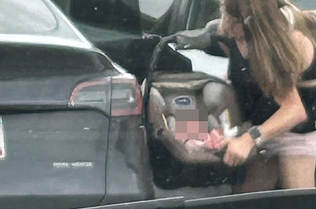 Yapışık ikizlerden bebekli fotoğraf: Tıp dünyası şokta