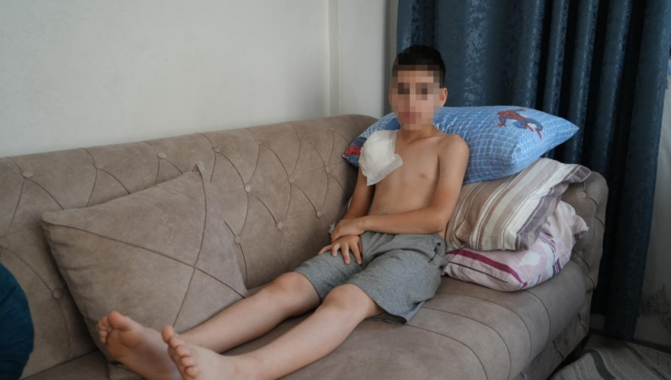 Samsun'da köpeğin saldırdığı 11 yaşındaki çocuğun kolu felç kaldı