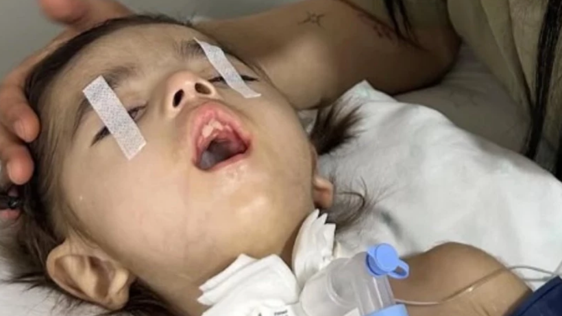Arızalı solunum cihazı nedeniyle SMA tedavisi gören 4 yaşındaki Yasmin Elif hayatını kaybetti - Resim : 2