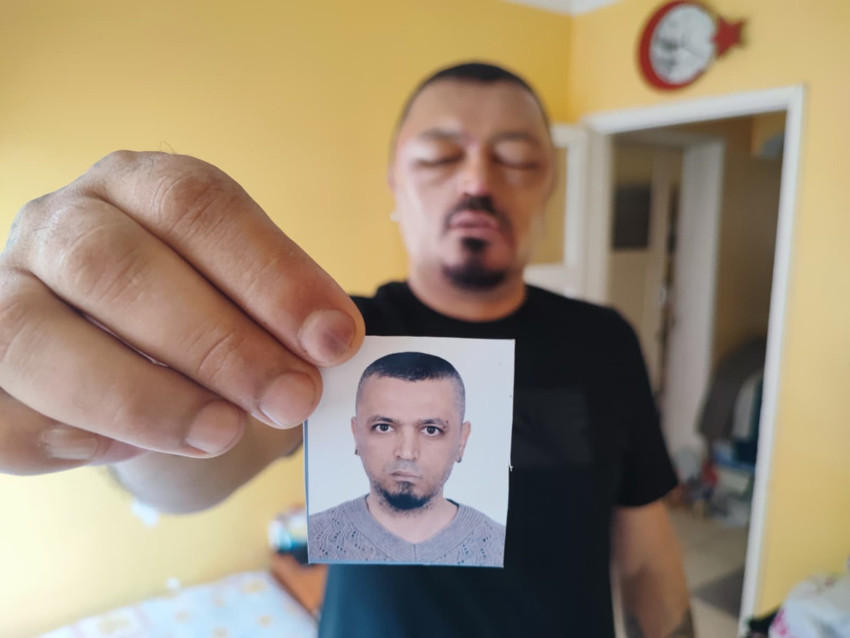 Berber tavsiyesi hastanelik etti! Saç siyahlaştırıcı şampuan hayatını kabusa çevirdi - Resim : 3