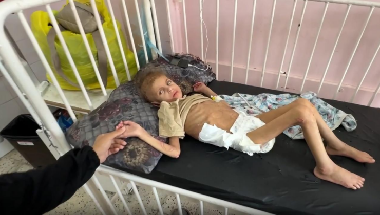 Gazzede yetersiz beslenme sonucu 12 kiloya düşen 7 yaşındaki May yürüme yetisini kaybetti