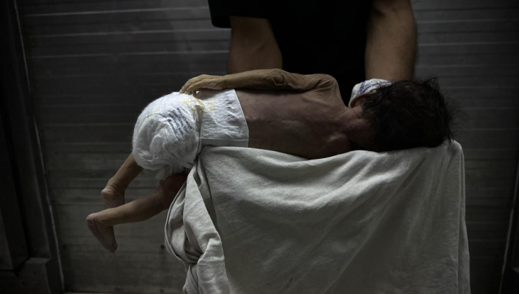 Soykırımcı İsrail'in kıtlığı dayattığı Gazze'de 453 kişi açlıktan hayatını kaybetti