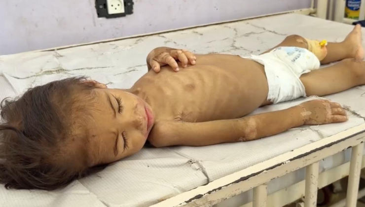 Gazze'de hastanelerdeki çocuklar adeta açlıktan ölümü bekliyor