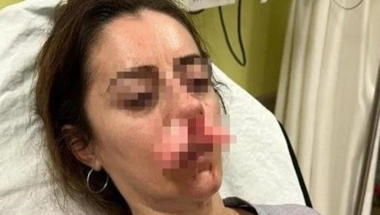 Otomobilin kapısı silah sayıldı!