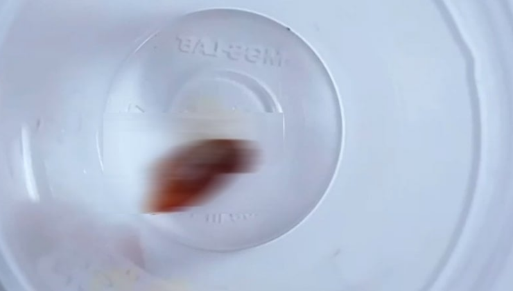 Bir buçuk yıldır geçmeyen öksürüğün nedenini öğrenince şoke oldu